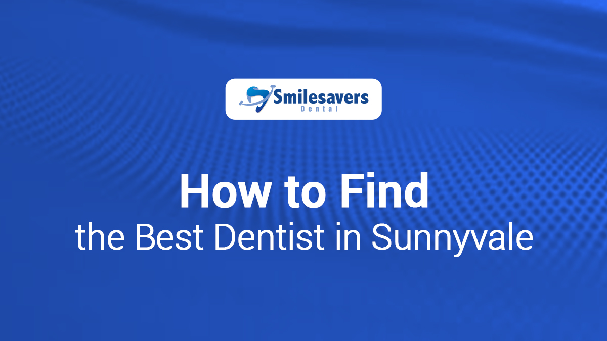 How to Find the Best Dentist in Sunnyvale