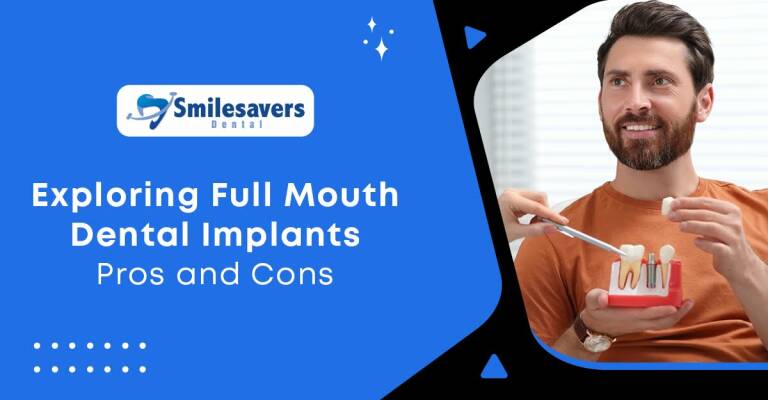 Exploring Full Mouth Dental Implants: Pros and Cons