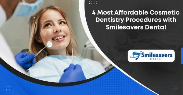 4 Most Affordable Cosmetic Dentistry Procedures