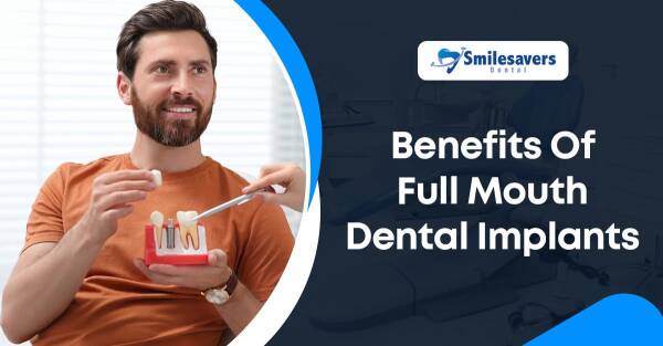 Benefits Of Full Mouth Dental Implants