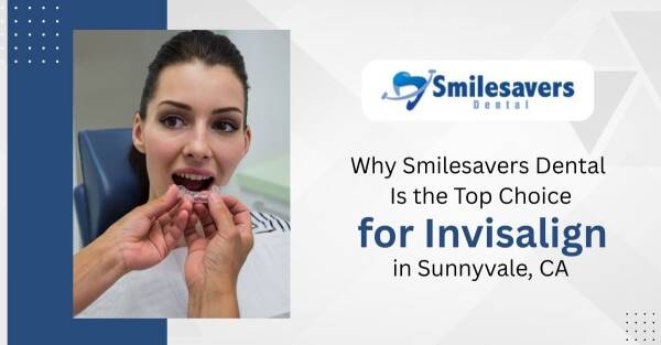 Smilesavers Dental Is the Top Choice for Invisalign in Sunnyvale