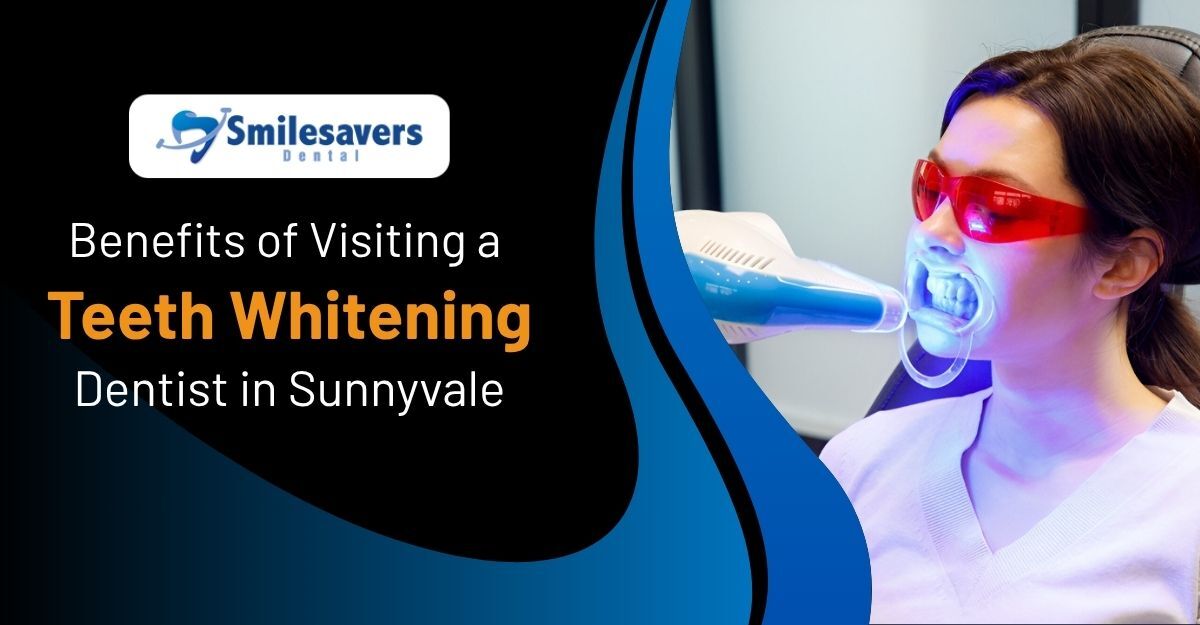 Benefits of Visiting a Teeth Whitening Dentist in Sunnyvale